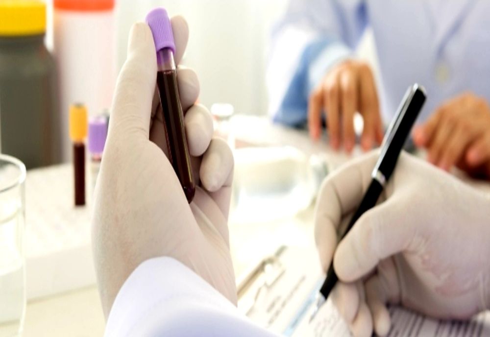 131 de teste la Vâlcea: 64 negative, 2 pozitive, 65 de probe se află în lucru